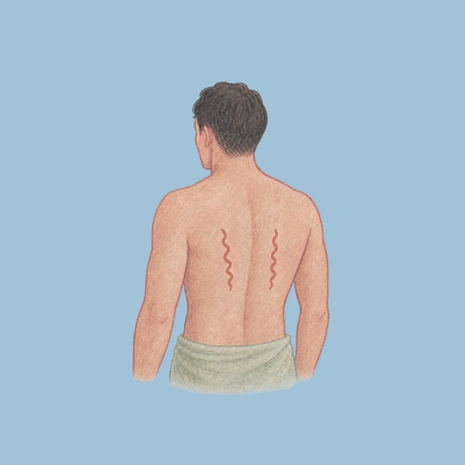 Back tension illustration