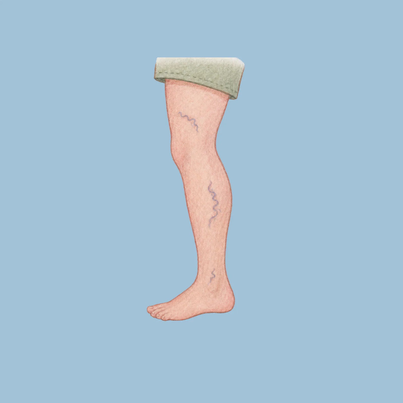 Calf tightness illustration